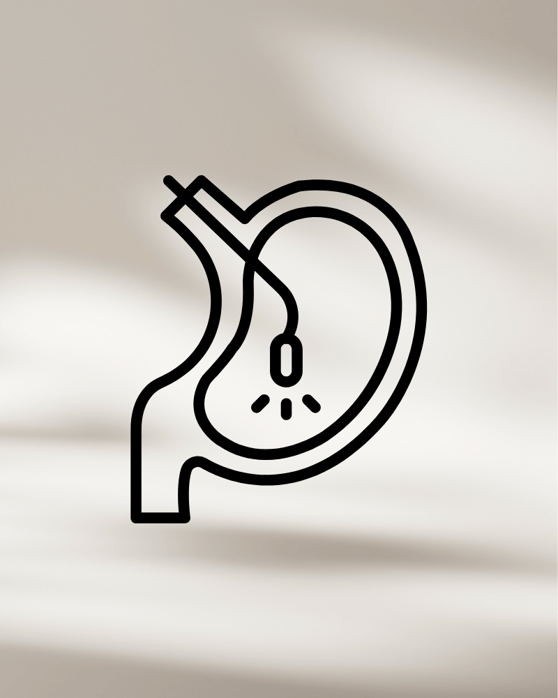 Videoendoscopia Videoendoscopia (endoscopia)